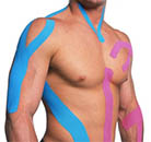 Тейпирование